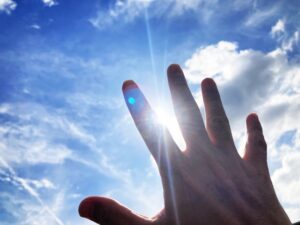 それでも焼けてしまったら…「後悔」を「ケア」に変える対策法